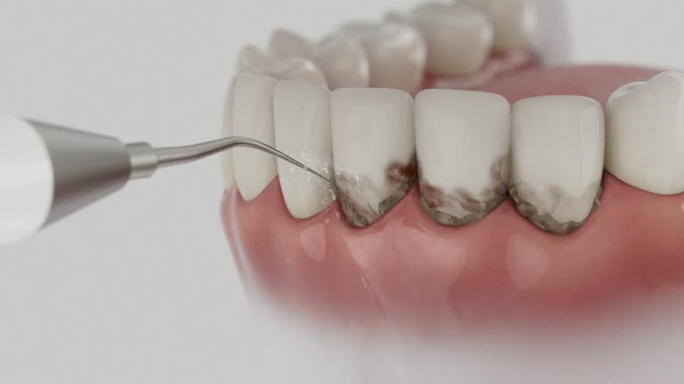 Trusted Teeth Cleaning And Checkup service in Woodstown, NJ - Dentist Open Now